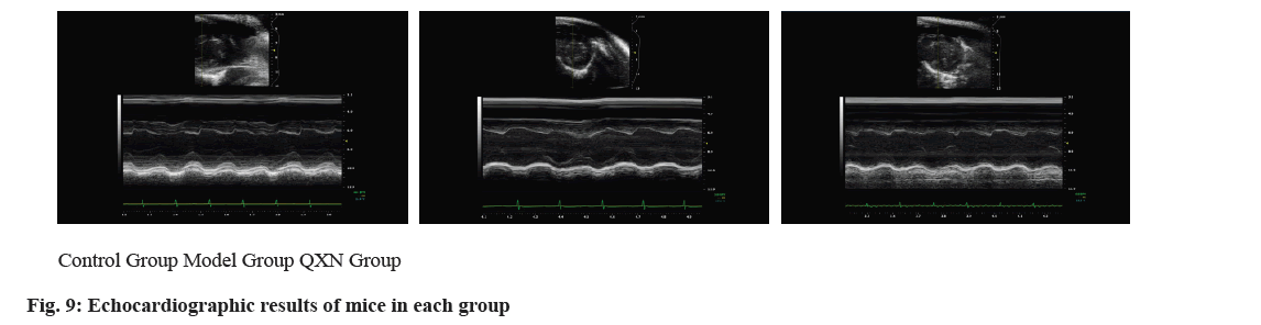 IJPS-Echocardiographic