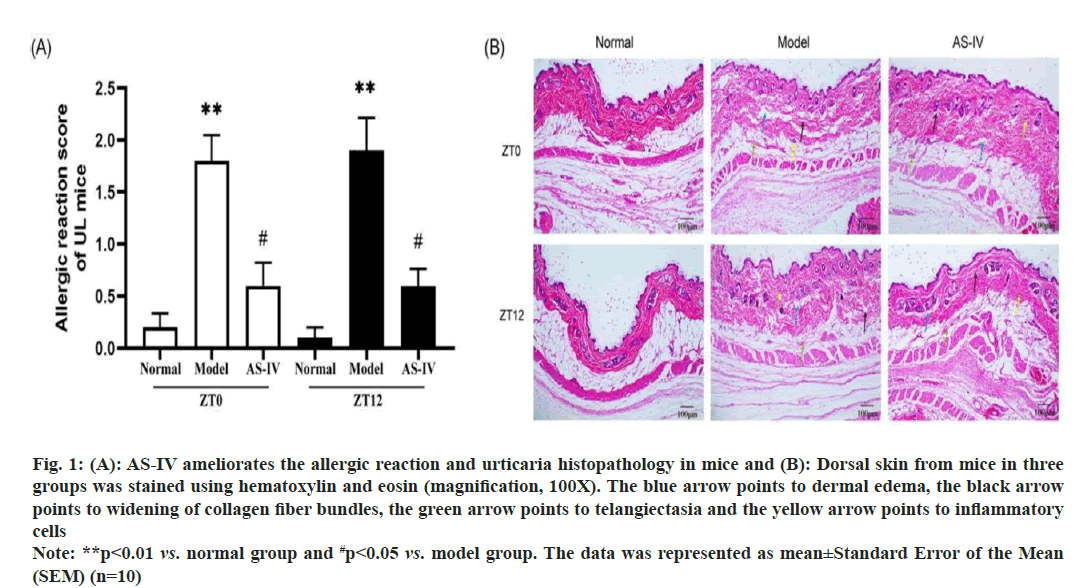 IJPS-allergic-reaction