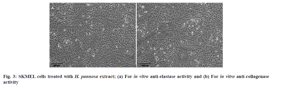 IJPS-anti-elastase