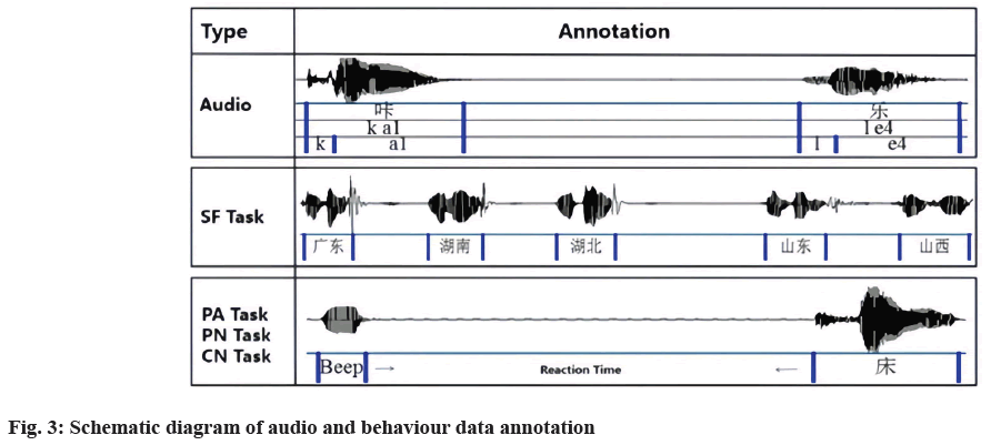 audio