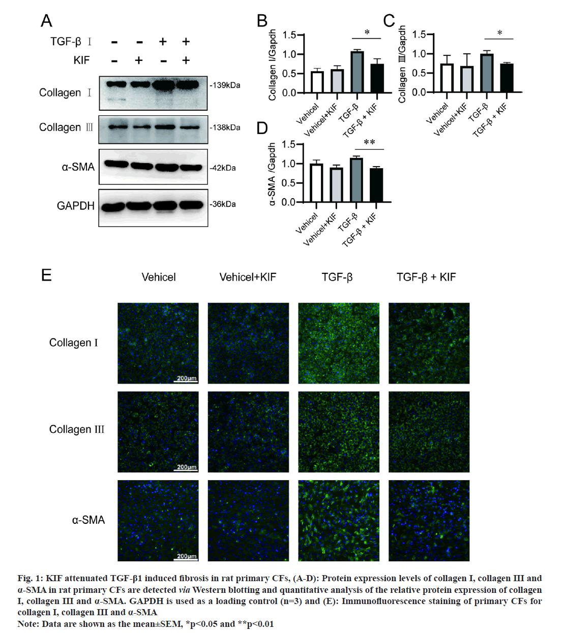 IJPS-fibrosis