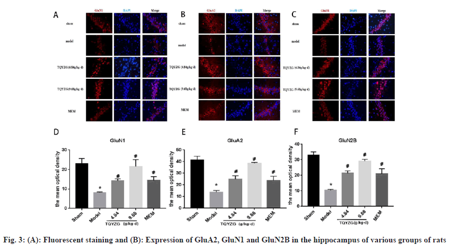 IJPS-hippocampus