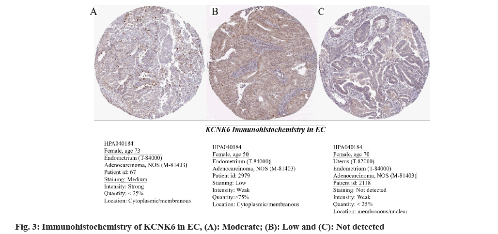 IJPS-immunohistochemistry