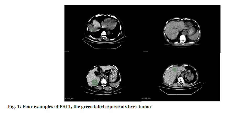 IJPS-liver