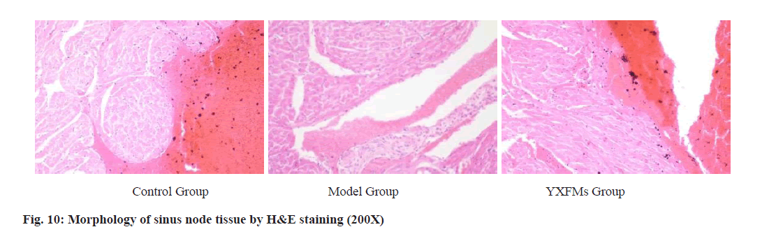 IJPS-node-tissue