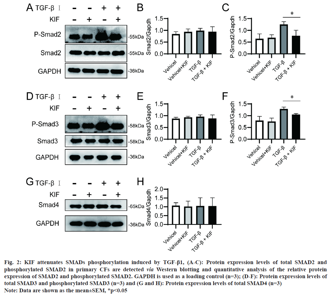 IJPS-phosphorylation