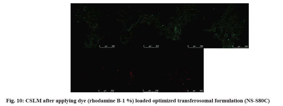 IJPS-transferosomal