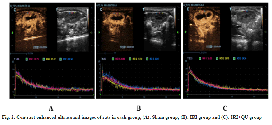 ultrasound