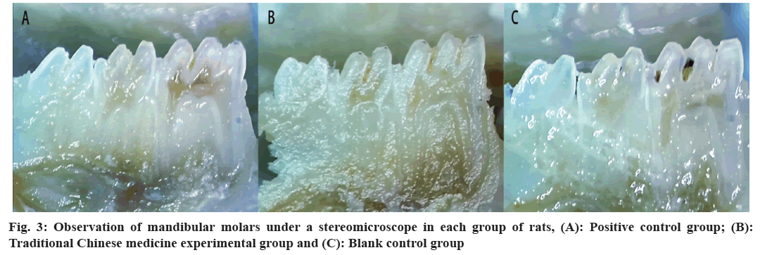 mandibular